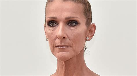 current health of celine dion